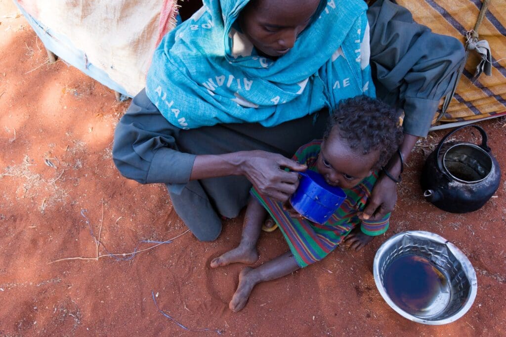 Children suffer from malnutrition as a result of the famine in Somalia