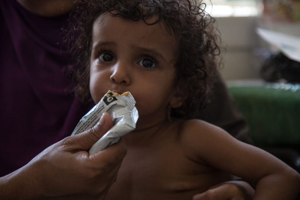 WFP supplementary food packets help keep malnourished children in Yemen from starving