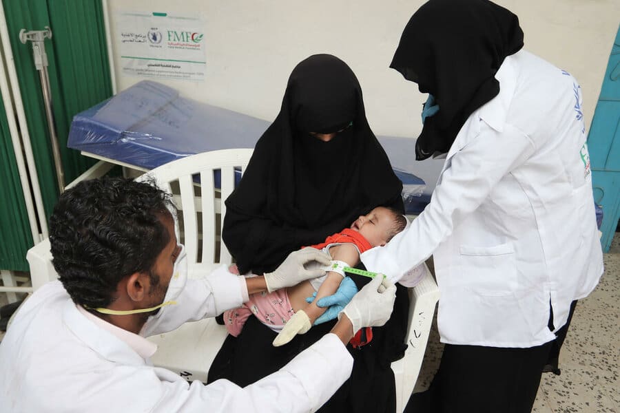 Famine in Yemen causes malnutrition in children