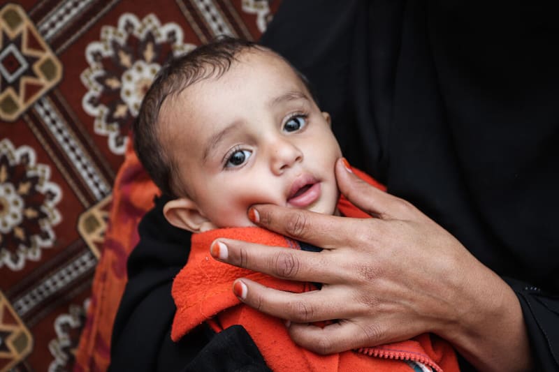 Mother holds a baby in Yemen, who is suffering from malnutrition due to famine