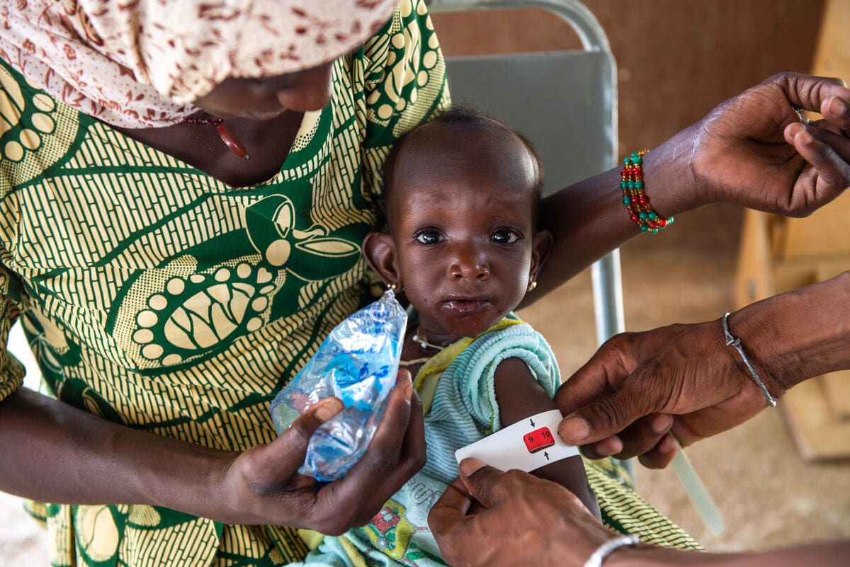 Child is treated for malnutrition